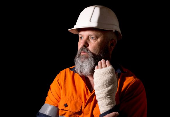 construction worker holds up injury