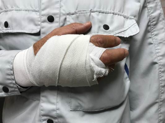 a man holds up arm in pain after getting injured on the job
